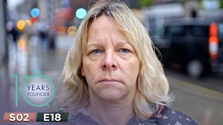 30 Years of Bulimia Left Her Afraid to Smile | 10 Years Younger In 10 Days Season 2 Episode 18