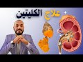 أفضل 10 أطعمة للتخلص من سموم الكلى مهم جداا للسكري ايضا