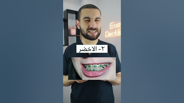 ٤ الوان rubber band لتقويم الاسنان اوعي تعملهم ❌