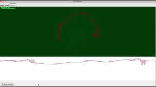 RADAR Screen