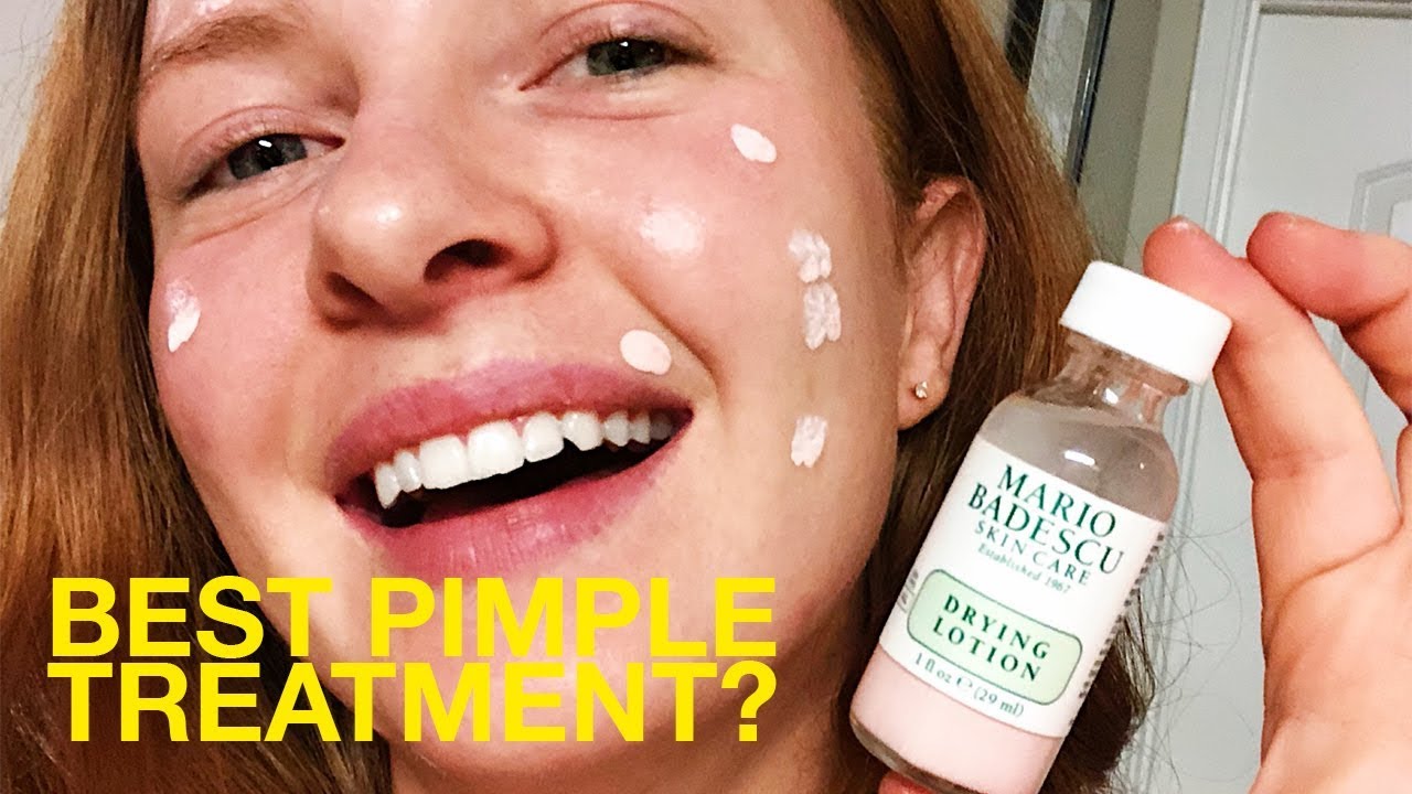 Best Pimple Spot I Try Mario Badescu Lotion - YouTube