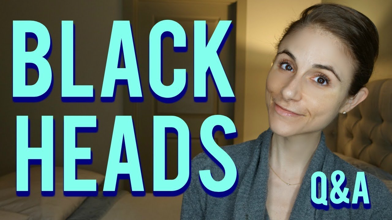 blackhead removal q a