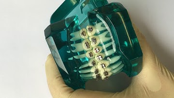 Triamond - How to open the clip when elastic chains are placed