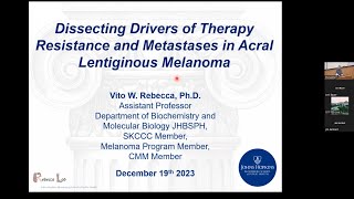 Dissecting Drivers of Therapy Resistance and Metastases in Acral Lentiginous Melanoma