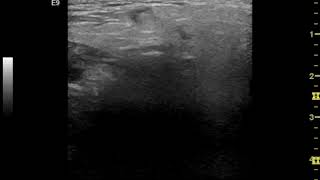 Details IMC63 Image01 News