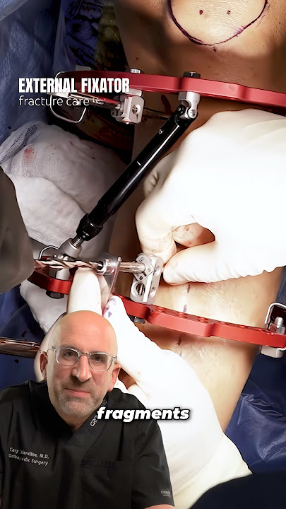 Surprising Waterproof Repair for Broken Bones⁉️