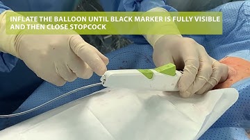 How to use MYNX CONTROL™ Vascular Closure Device