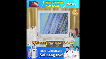 Soi nang tóc mà kinh hãi, thì ra muốn trị rụng tóc thì phải biết rõ điều này!