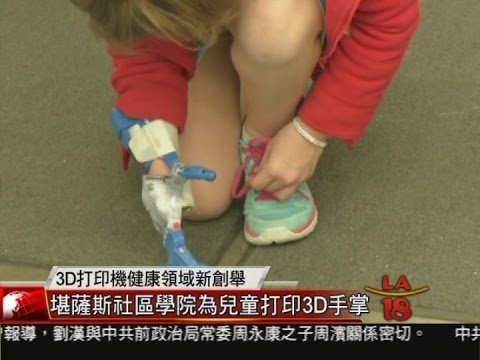 [為殘障兒童打印3D手掌] 洛城18台晚間新聞02092015