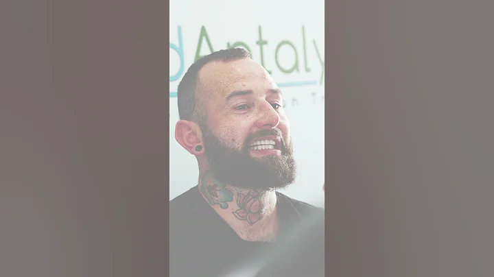 #smiletransformation with zirconia porcelain veneers #shorts  #dentalclinic #veneers #hollywoodsmile