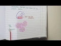 Lobar Pneumonia And Bronchopneumonia | Pathology