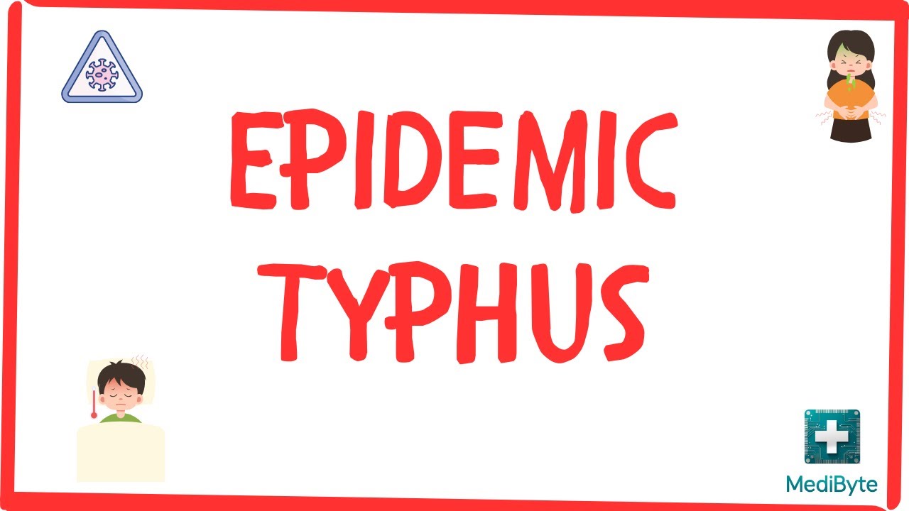 What is Epidemic Typhus?