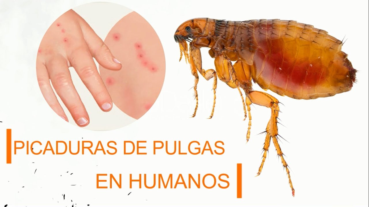 Como eliminar pulgas en humanos