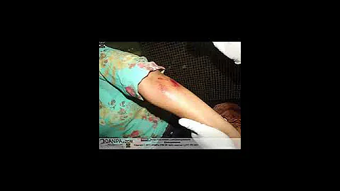 Parte medico Jacqueline Galvn