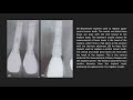 Implants in Clinical Dentistry  01 Overview of Implant Dentistry: Dr hamzah abbas