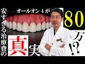 オールオン4が80万⁉安すぎる治療費には理由がある！ナルト先生