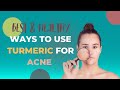 Best &amp; Healthy Ways to Use Turmeric for Acne
