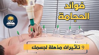 فوائد الحجامة 9 تأثرات لن تجدهم إلا فيها ولهذه الأسباب يجب ان تستخدمها