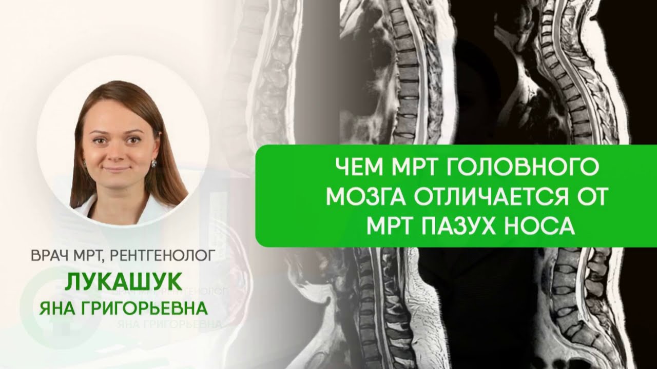 МРТ пазух носа - что покажет и как делают?