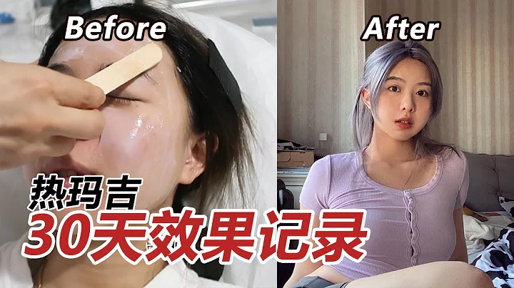 花2萬人民幣做貴婦醫美熱瑪吉值得嗎？我的30天變化全記錄 - 天天要聞