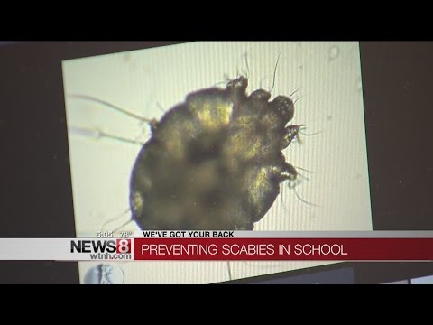 What you need to know about a common skin infection