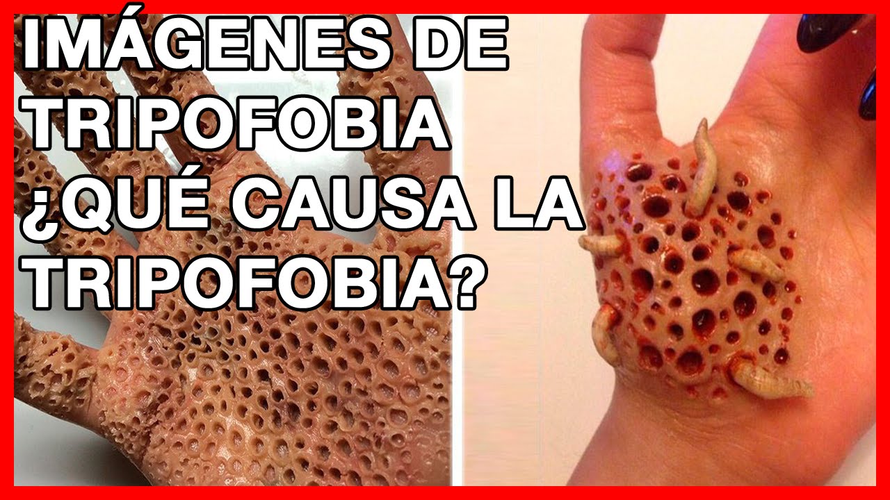  Qu  es  la Tripofobia Qu  Causa la Tripofobia Im genes 