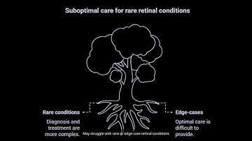 AI Breakthrough in Eye Care: See Individual Eye Cells Without Lab Equipment!