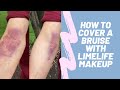 How to Cover a Bruise | LimeLife Concealer and Foundation