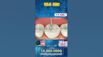 [3D] TRÁM RĂNG || Nha Khoa Quốc Tế Athena