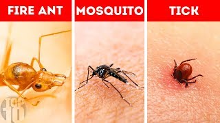 10 Bug Bites You Need To Be Able to Identify