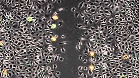 Automated mitosis detection in wound healing assay