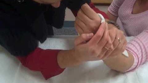 Splinting by an Occupational Therapist part 2