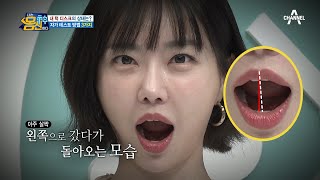 입이 삐뚤게 벌어지는 건 턱관절 이상신호? 몸신 가족들의 턱 디스크 건강 점검 | 나는 몸신이다 376 회