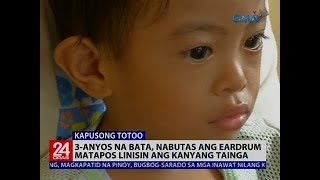 3-Anyos Na Bata, Nabutas Ang Eardrum Matapos Linisin Ang Kanyang Tainga