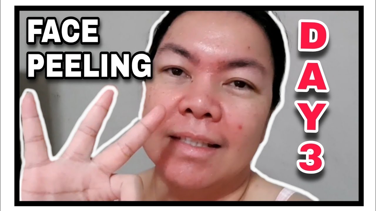 DAY 3 FACE PEELING SESSION with TIPS FOR SENSITIVE SKIN YouTube