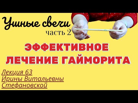 ЛЕЧЕНИЕ ГАЙМОРИТА ДОМА С ПОМОЩЬЮ УШНЫХ СВЕЧЕЙ. Фитотерапия. Выпуск 63