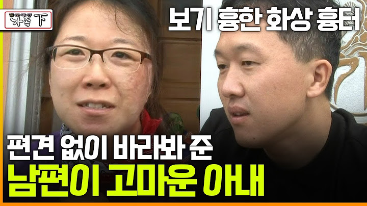 [멜로다큐 '가족' 289회 下] 보기 흉한 화상 흉터 편견 없이 바라봐 준 남편이 고마운 아내