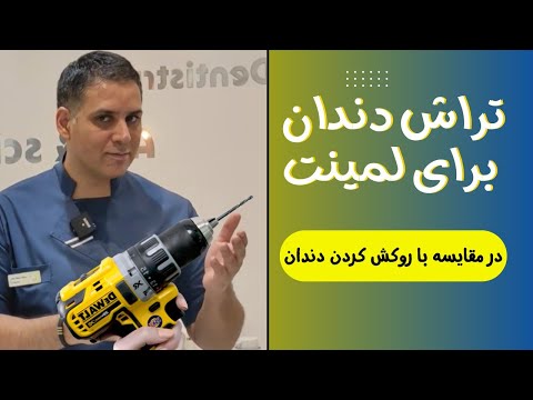 مقایسه مقدار تراش دندان برای انجام لمینت سرامیکی دربرابر مقدار تراش لازم برای روکش کردن دندان