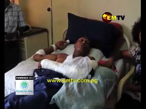 Teacher at Tusbab Secondary School Attacked by a Student