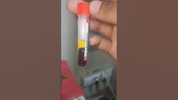 How does one separate serum from 🩸using the centrifuge#shorts #centrifuge #viral