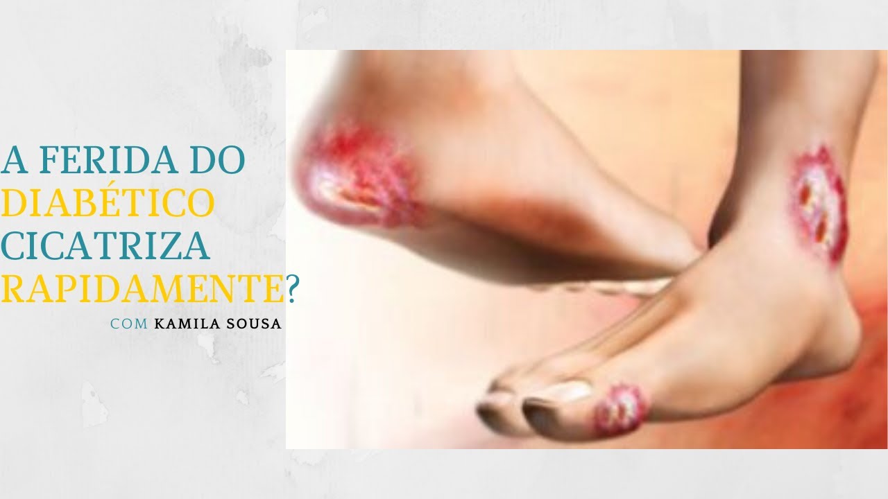 A FERIDA DO DIABÉTICO CICATRIZA RAPIADAMENTE? YouTube A FERIDA DO DIABÉTICO CICATRIZA RAPIADAMENTE? YouTube
