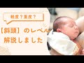 【斜頭】我が子の変形レベルを知るために軽度から超重度までタイプ別に解説