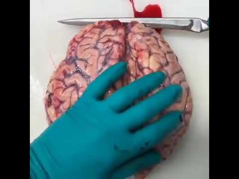 Видео: Откуда взялся головной мозг?