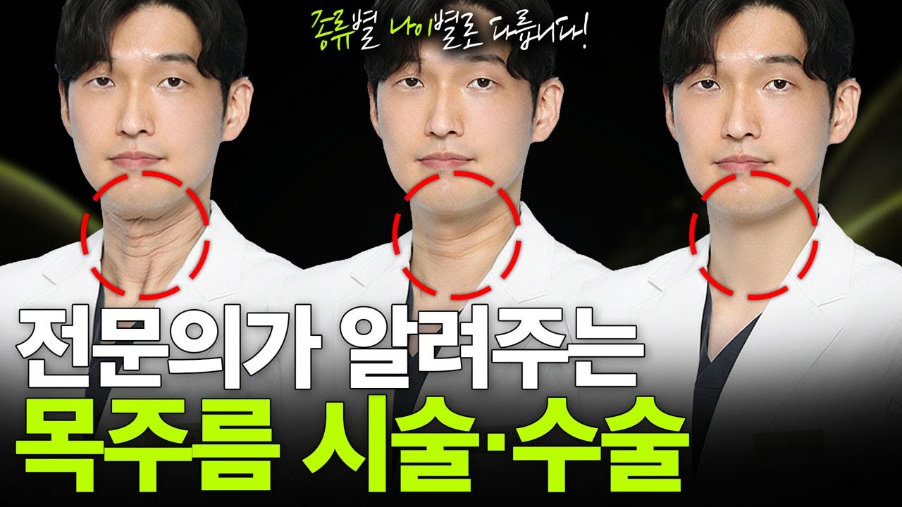 목주름 100% 정리🔥원인부터 연령대별 시술·수술 추천까지 한 편에 총정리!