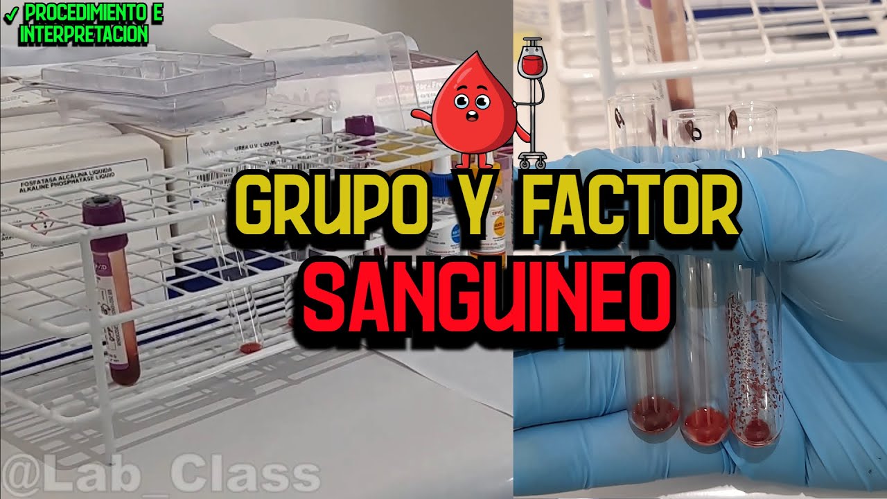 Grupo y Factor Sanguíneo: Procedimiento Explicado - YouTube