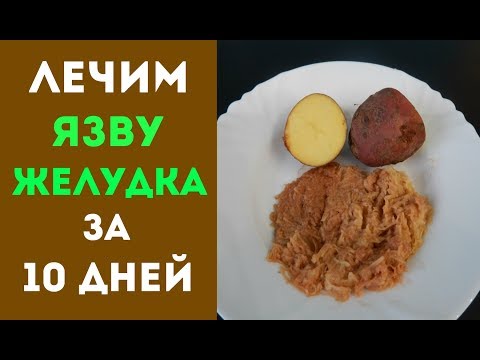 КАК ВЫЛЕЧИТЬ  ЯЗВУ ЖЕЛУДКА И ГАСТРИТ ЗА 10 ДНЕЙ КАРТОФЕЛЕМ