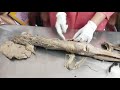 cadaver anatomy-Lower limb