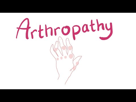 Arthropathy | Joint Pathology Classification