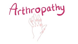 Arthropathy | Joint Pathology Classification