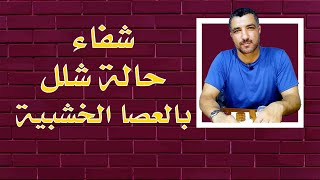 شفاء حالة ( شلل ) بالعصا الخشبية.. احمد العرباوي علاج الغضروف بالعصاية الخشبية